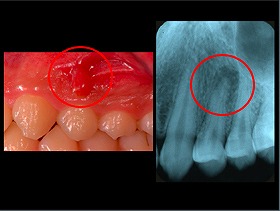 口腔内写真とデジタルXray写真（2次元