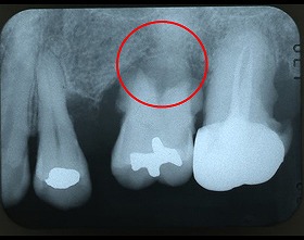 デジタルXray写真（2次元）