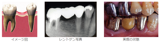 診査・診断・術前計画