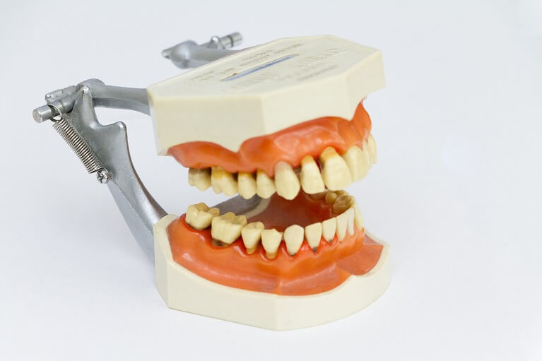 歯周病治療とは